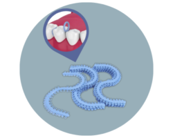 ELASTICI SEPARATORI A “S”